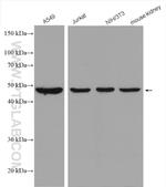 PSMC5 Antibody in Western Blot (WB)
