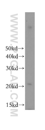 SEC11A Antibody in Western Blot (WB)