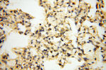 ACAT2 Antibody in Immunohistochemistry (Paraffin) (IHC (P))
