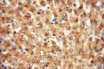 ACAT2 Antibody in Immunohistochemistry (Paraffin) (IHC (P))