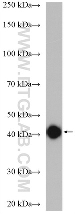 ACAT2 Antibody in Western Blot (WB)