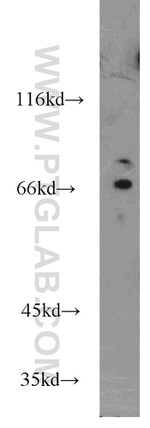 AARE Antibody in Western Blot (WB)