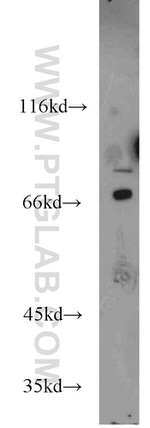 AARE Antibody in Western Blot (WB)