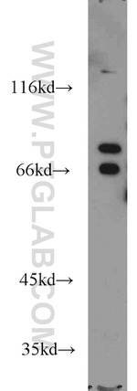 AARE Antibody in Western Blot (WB)