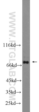 AARE Antibody in Western Blot (WB)