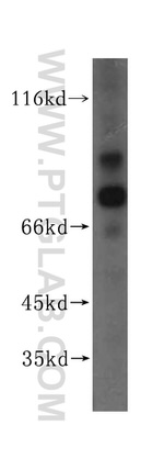 AARE Antibody in Western Blot (WB)