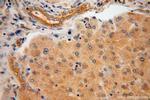 AARE Antibody in Immunohistochemistry (Paraffin) (IHC (P))
