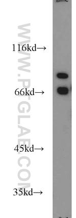 AARE Antibody in Western Blot (WB)
