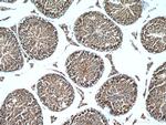WRAP53 Antibody in Immunohistochemistry (Paraffin) (IHC (P))