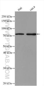WRAP53 Antibody in Western Blot (WB)