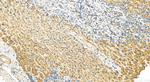 MRPL16 Antibody in Immunohistochemistry (Paraffin) (IHC (P))