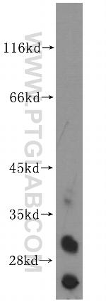 WDR4 Antibody in Western Blot (WB)