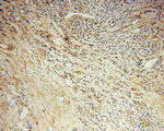 Noggin Antibody in Immunohistochemistry (Paraffin) (IHC (P))