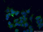 SEC22B Antibody in Immunocytochemistry (ICC/IF)