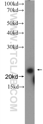 SEC22B Antibody in Western Blot (WB)