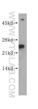 SEC22B Antibody in Western Blot (WB)