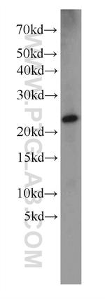 Dermatopontin Antibody in Western Blot (WB)