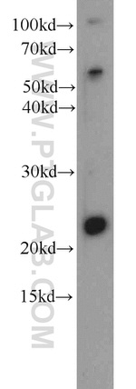 Dermatopontin Antibody in Western Blot (WB)