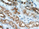 ATP6V1B1 Antibody in Immunohistochemistry (Paraffin) (IHC (P))