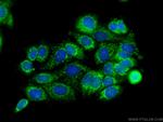 SMTNL2 Antibody in Immunocytochemistry (ICC/IF)