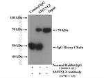 SMTNL2 Antibody in Immunoprecipitation (IP)