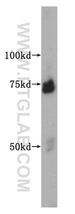 SMTNL2 Antibody in Western Blot (WB)