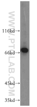 SMTNL2 Antibody in Western Blot (WB)