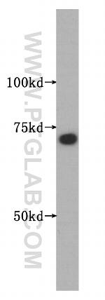 SMTNL2 Antibody in Western Blot (WB)