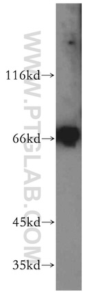 SMTNL2 Antibody in Western Blot (WB)