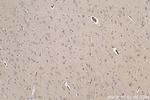 PCDHB10 Antibody in Immunohistochemistry (Paraffin) (IHC (P))