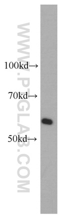 CAMKV Antibody in Western Blot (WB)