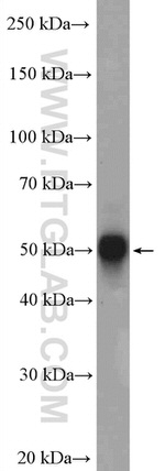 CAMKV Antibody in Western Blot (WB)