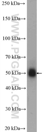 CAMKV Antibody in Western Blot (WB)