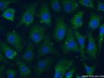 CAMKV Antibody in Immunocytochemistry (ICC/IF)