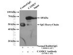 CAMKV Antibody in Immunoprecipitation (IP)