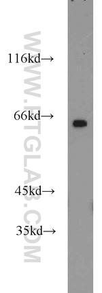 CAMKV Antibody in Western Blot (WB)