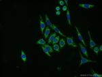 NDUFB8 Antibody in Immunocytochemistry (ICC/IF)