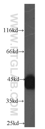 HMBS Antibody in Western Blot (WB)