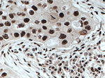 DDX39B Antibody in Immunohistochemistry (Paraffin) (IHC (P))
