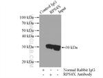 RPS4X Antibody in Immunoprecipitation (IP)