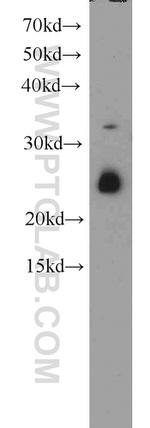 CRIP2 Antibody in Western Blot (WB)