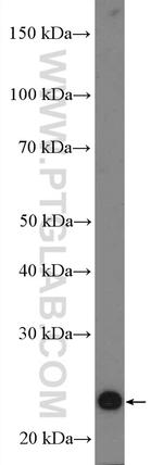 CRIP2 Antibody in Western Blot (WB)