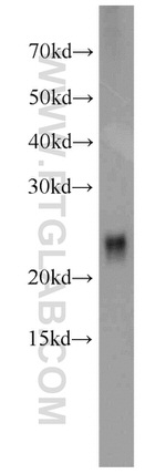 CRIP2 Antibody in Western Blot (WB)