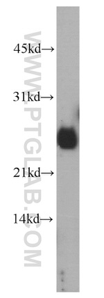 CRIP2 Antibody in Western Blot (WB)