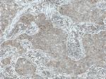 ARD1A Antibody in Immunohistochemistry (Paraffin) (IHC (P))