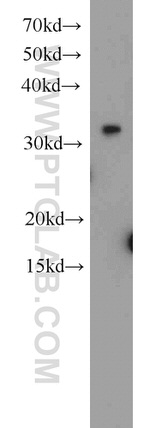EXOSC2 Antibody in Western Blot (WB)