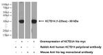 KCTD14 Antibody in Western Blot (WB)