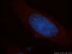 CCDC28A Antibody in Immunocytochemistry (ICC/IF)