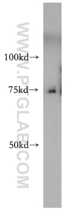 CCDC28A Antibody in Western Blot (WB)