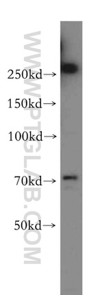 CCDC28A Antibody in Western Blot (WB)